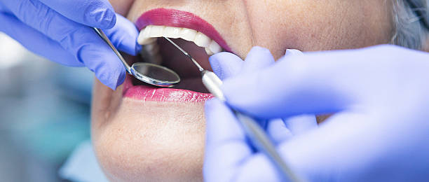 Best Emergency Root Canal Treatment in Holley, NY